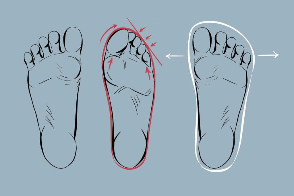 How to Transition to Barefoot Shoes: Barefoot Shoes vs Conventional Shoes
